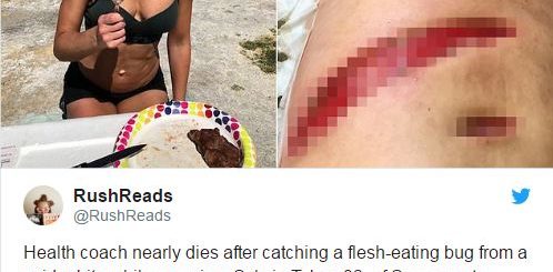 加州素食女子被蜘蛛咬伤,腹部出现3大洞, 改吃牛排居然恢复健康