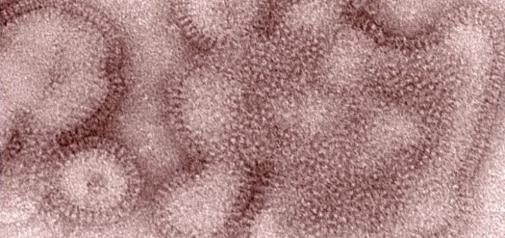两波流感病毒创造了美国十年来最长的流感季