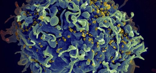 距治癒艾滋病又近一步 美科學家首次消滅老鼠病毒