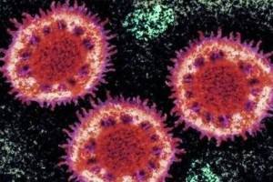 新型冠狀病毒感染的肺炎「採取甲類管理」，意味著什麼？