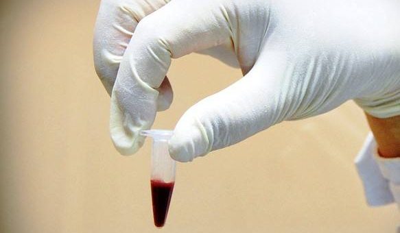 中國生物：康復者血漿製品投入臨床，10人體征癥狀明顯好轉