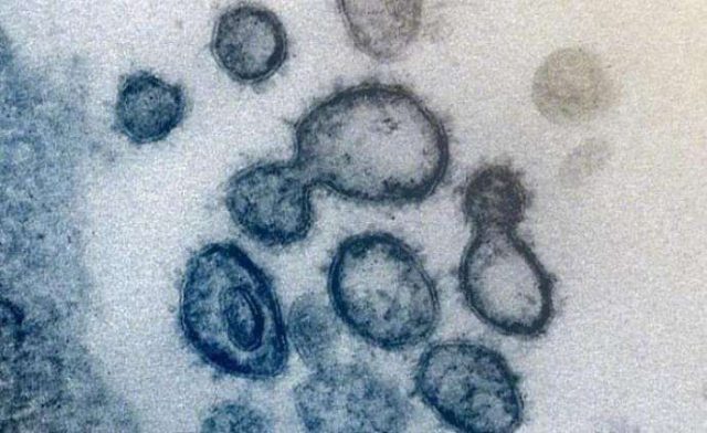 世卫组织宣布新冠疫情“全球大流行”，这意味着什么？