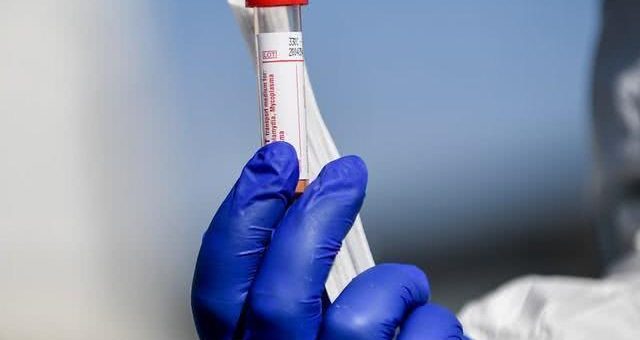 抗疫曙光！牛津大學給猴子注射新冠疫苗，28天暴露病毒中未感染