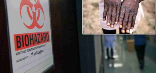 CDC證實美國一旅客感染猴痘，死亡率高達10%，無疫苗！