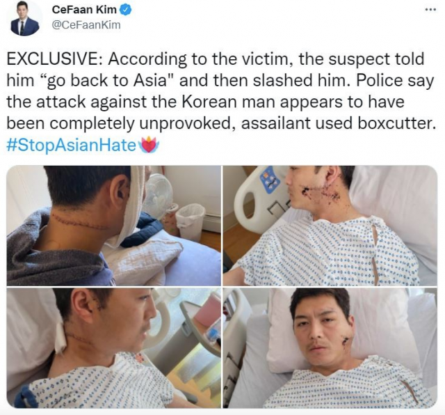 怒了! 華裔男子當街遭鎚子砸頭 滿臉鮮血! 還有人遭割臉 