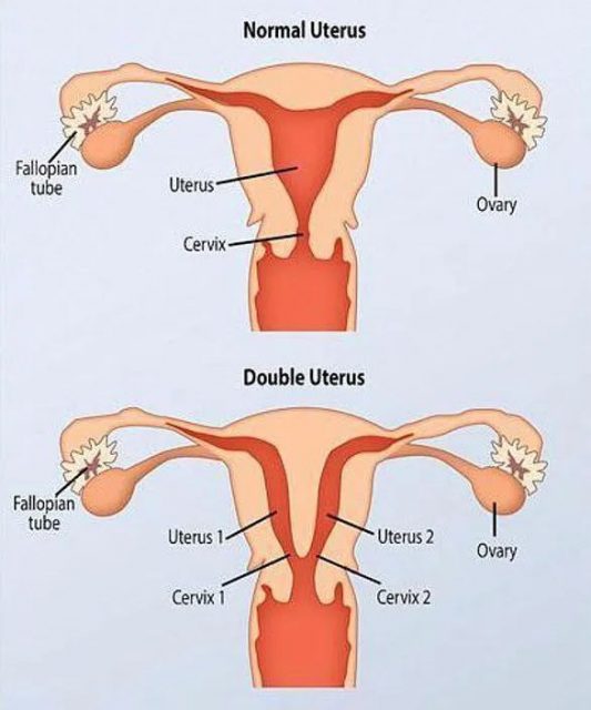 美国女子天生有双生殖器官，可以一个月内怀上两个孩子？！