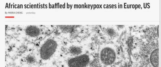 全面爆發！紐約出現第一例猴痘病例！15國143例確診，全球持續擴散！暫無治療方法！