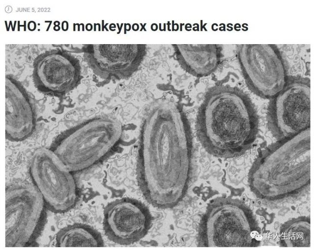 纽约已确诊5例！WHO称猴痘已在华人最多社区中传播，遏制恐太晚