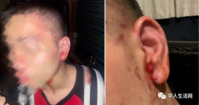 頭破血流！中國留學生無端遭暴力群毆 警方公布襲擊者照片：是慣犯！