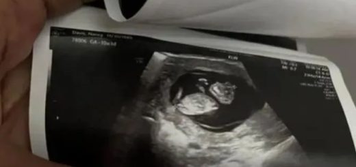 产检发现胎儿有致命缺陷。医生：本州禁止堕胎，必须继续怀着，直到ta死...