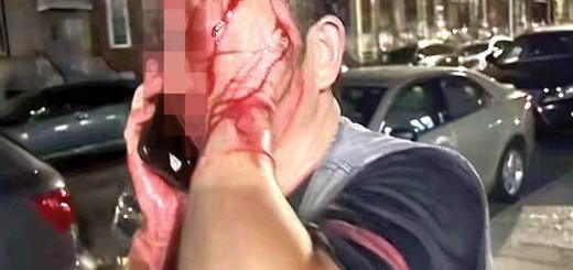 滿臉是血！華裔外賣郎送餐途中遭爆頭搶劫！瞬間血如泉涌！