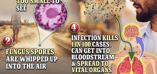 警惕! 一种恐怖传染病正在美国扩散! 致死率高流感10倍! “呼吸1次”就感染 已有中国公民死亡!