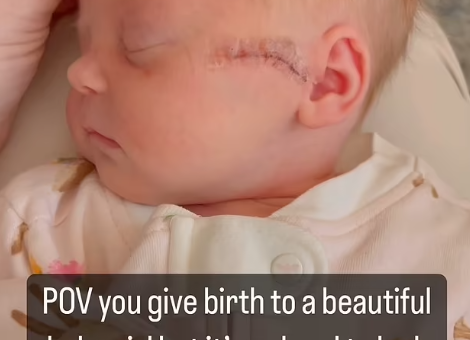 可怕！美國女子進行剖腹產 醫生「下刀太深」切開嬰兒臉​