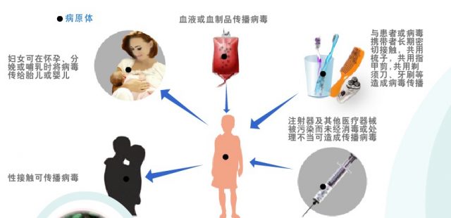 美國6州爆發甲肝疫情 2500人病！華人聚居州中招！