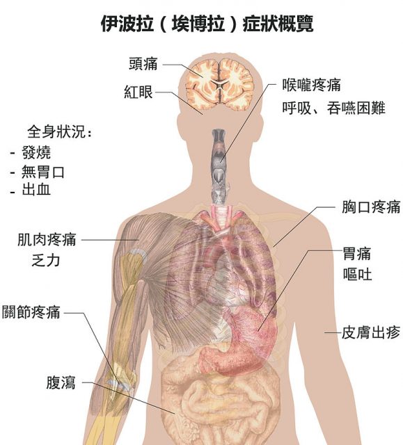 4例样本被确认为阳性埃博拉病毒 这次的病毒会在全球扩散吗？