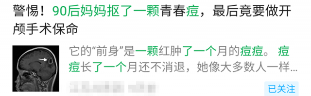 吓人！姑娘抠了一颗痘，竟要做开颅手术！这个部位的痘千万不能动，否则…