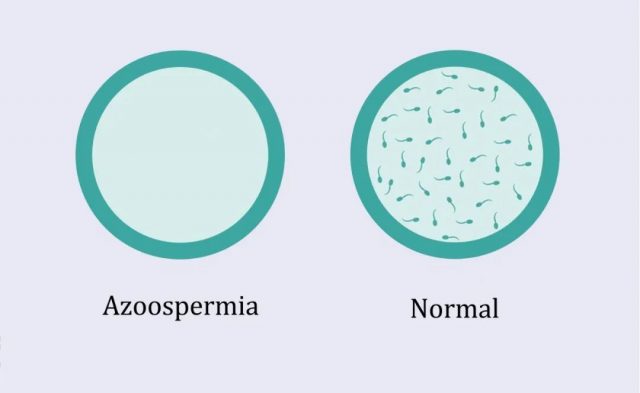 大量新冠患者康复后出现无精症！这个病毒的可怕后遗症，越挖越多...